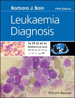 Leukaemia Diagnosis Leukaemia Diagnosis