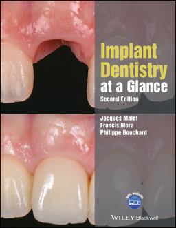 Implant Dentistry at a Glance 2nd 9781119292609 Front Cover