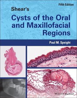 Shear's Cysts of the Oral and Maxillofacial Regions 5th 9781119354994 Front Cover