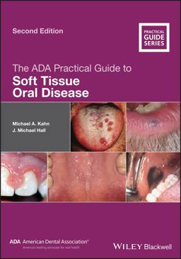 ADA Practical Guide to Soft Tissue Oral Disease 2nd 9781119437338 Front Cover
