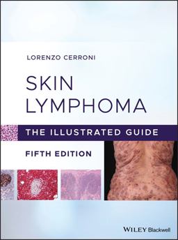 Skin Lymphoma: The Illustrated Guide  9781119485902 Front Cover