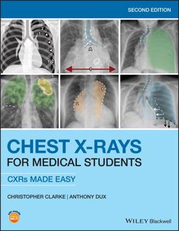 Chest X-rays for Medical Students: Cxrs Made Easy  9781119504153 Front Cover