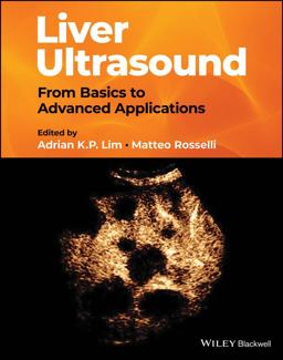 Liver Ultrasound From Basics to Advanced Applications  9781119612599 Front Cover