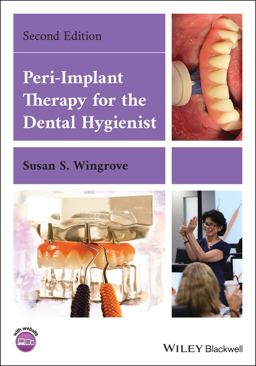Peri-Implant Therapy for the Dental Hygienist 2nd 9781119766186 Front Cover