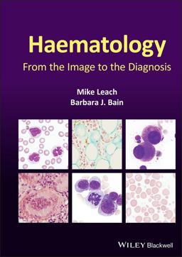 Haematology Haematology