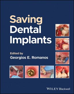 Saving Dental Implants  9781119807018 Front Cover
