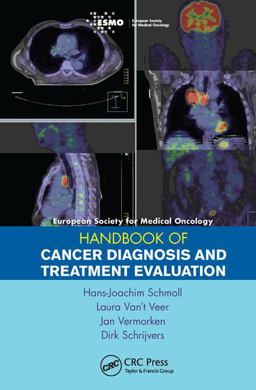 ESMO Handbook of Cancer Diagnosis and Treatment Evaluation  9781138455375 Front Cover