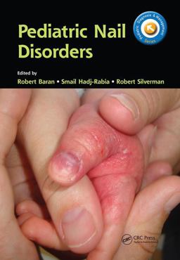 Pediatric Nail Disorders  9781138704343 Front Cover