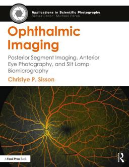 Ophthalmic Imaging Posterior Segment Imaging, Anterior Eye Photography, and Slit Lamp Biomicrography  9781138886001 Front Cover