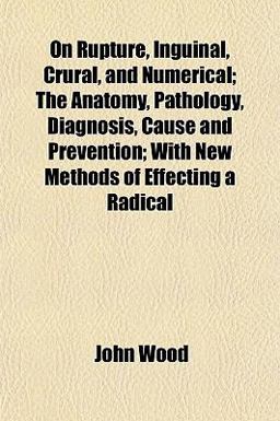 On Rupture, Inguinal, Crural, and Numerical; the Anatomy, Pathology, Diagnosis, Cause and Prevention; with New Methods of Effecting a Radical On Rupture, Inguinal, Crural, and Numerical; the Anatomy, Pathology, Diagnosis, Cause and Prevention; with New Methods of Effecting a Radical