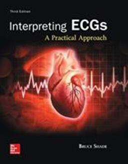 Interpreting ECGs