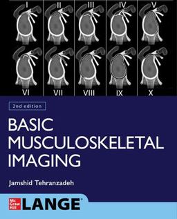 Basic Musculoskeletal Imaging, Second Edition 2nd 9781260459975 Front Cover