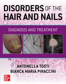     DISORDERS OF THE HAIR+NAILS  9781260462470 Front Cover