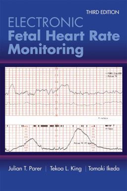 Electronic Fetal Heart Rate Monitoring:  9781284090338 Front Cover