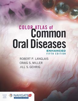 Color Atlas of Common Oral Diseases: 5th 9781284240986 Front Cover
