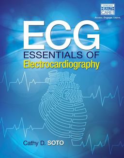 ECG Essentials of Electrocardiography  9781285180984 Front Cover