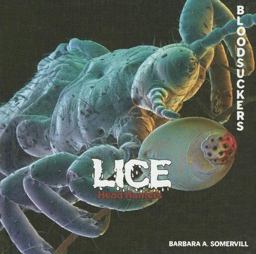 Lice