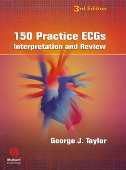 150 Practice ECGs Interpretation and Review 3rd 9781405104838 Front Cover