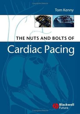 Nuts and Bolts of Cardiac Pacing 2nd 9781405132978 Front Cover
