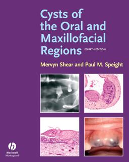 Cysts of the Oral and Maxillofacial Regions 4th 9781405149372 Front Cover