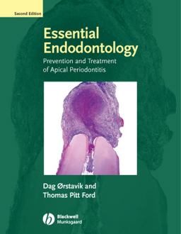Essential Endodontology Prevention and Treatment of Apical Periodontitis 2nd 9781405149761 Front Cover