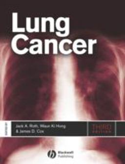 Lung Cancer Lung Cancer