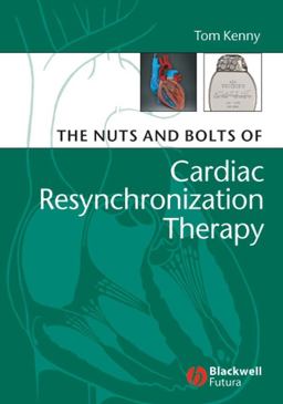 Nuts and Bolts of Cardiac Resynchronization Therapy  9781405153720 Front Cover