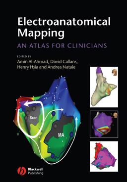 Electroanatomical Mapping Electroanatomical Mapping