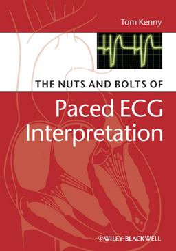 Nuts and Bolts of Paced ECG Interpretation  9781405184045 Front Cover