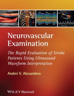 Neurovascular Examination The Rapid Evaluation of Stroke Patients Using Ultrasound Waveform Interpretation  9781405185301 Front Cover
