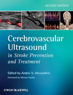 Cerebrovascular Ultrasound in Stroke Prevention and Treatment 2nd 9781405195768 Front Cover
