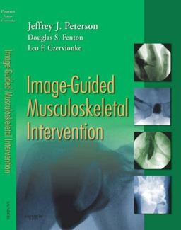 Image-Guided Musculoskeletal Intervention  9781416029052 Front Cover
