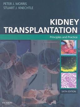 Kidney Transplantation