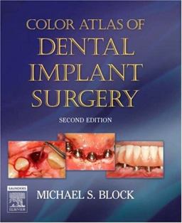 Color Atlas of Dental Implant Surgery