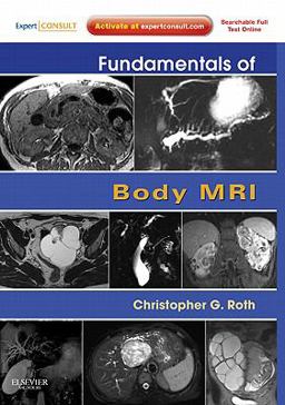 Fundamentals of Body MRI Expert Consult- Online and Print  9781416051831 Front Cover