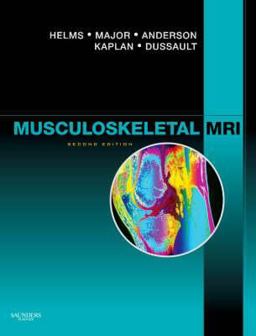 Musculoskeletal MRI 2nd 9781416055341 Front Cover