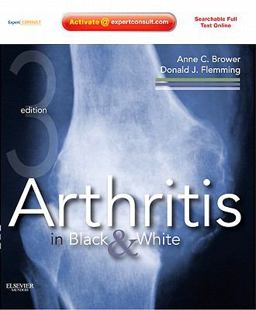 Arthritis in Black and White Expert Consult - Online and Print 3rd 9781416055952 Front Cover