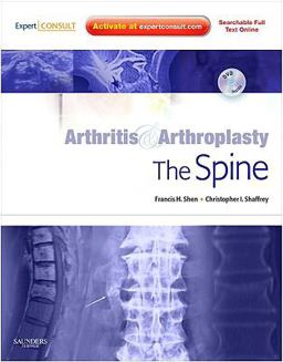 Arthritis and Arthroplasty: the Spine