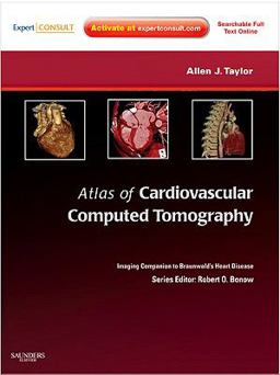 Atlas of Cardiovascular Computed Tomography  9781416061366 Front Cover