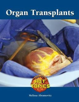 Organ Transplants Organ Transplants