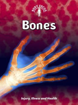 Bones