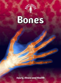 Bones