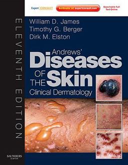 Andrews' Diseases of the Skin Clinical Dermatology 11th 9781437703146 Front Cover