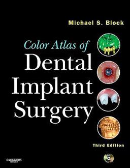 Color Atlas of Dental Implant Surgery 3rd 9781437708776 Front Cover