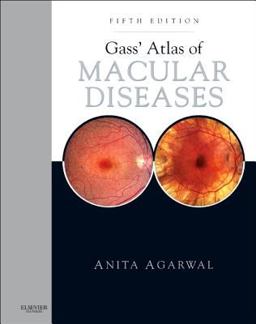 Gass' Atlas of Macular Diseases 2-Volume Set - Expert Consult: Online and Print 5th 9781437715804 Front Cover