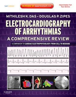 Electrocardiography of Arrhythmias: a Comprehensive Review A Companion to Cardiac Electrophysiology  9781437720297 Front Cover