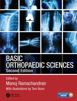 Basic Orthopaedic Sciences 2nd 9781444120981 Front Cover