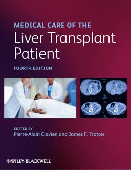 Medical Care of the Liver Transplant Patient 4th 9781444335910 Front Cover