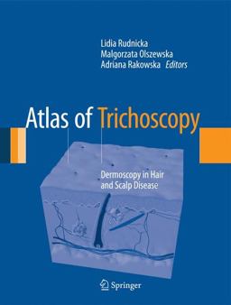 Atlas of Trichoscopy Dermoscopy in Hair and Scalp Disease  9781447144854 Front Cover