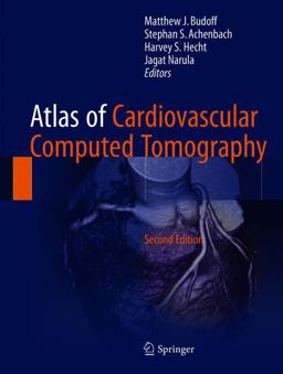 Atlas of Cardiovascular Computed Tomography 2nd 9781447173564 Front Cover